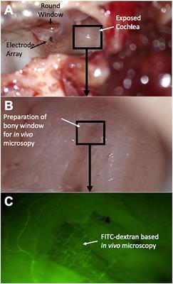 Cochlear implantation impairs intracochlear microcirculation and counteracts iNOS induction in guinea pigs